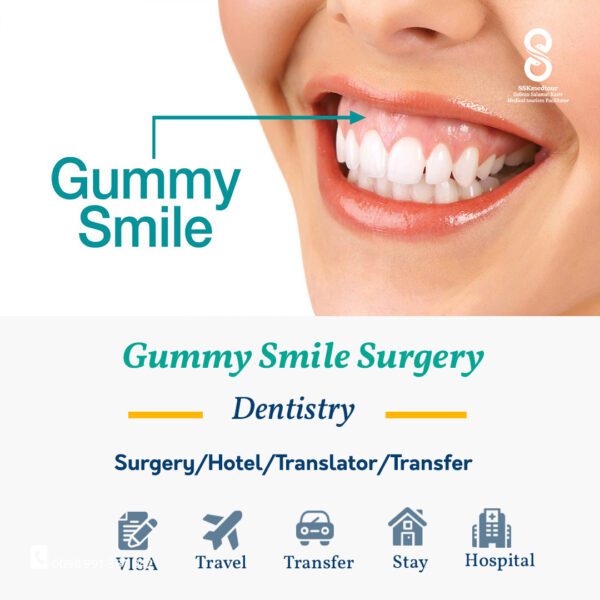 gummy smile package in iran