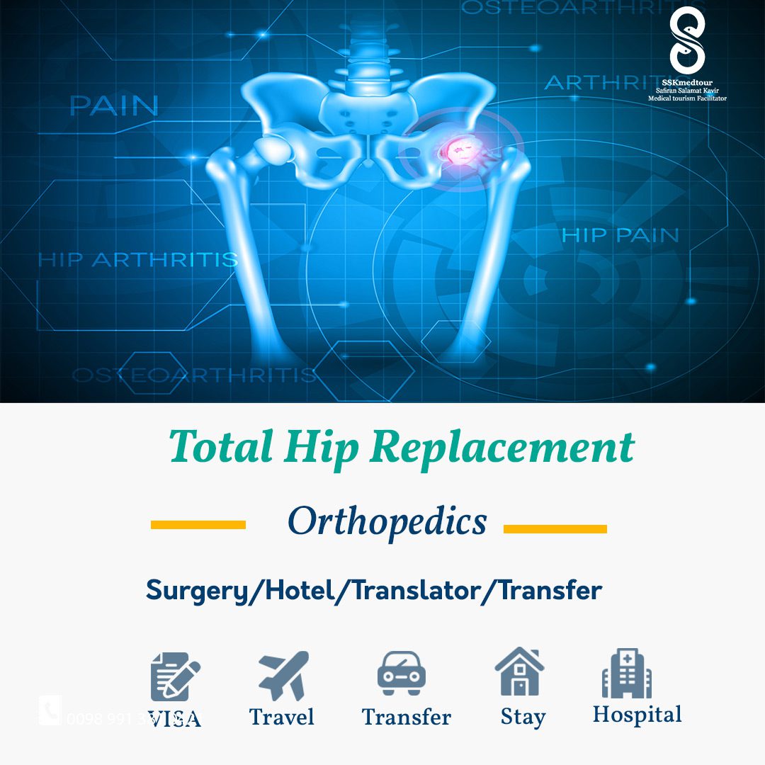 total hip replacement sskmedtour