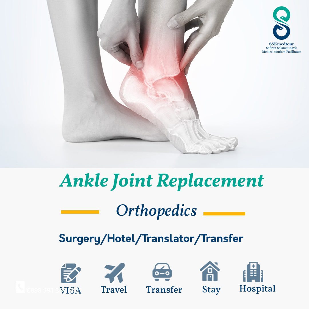 Ankle Joint Replacement - Safiran Salamat Kavir